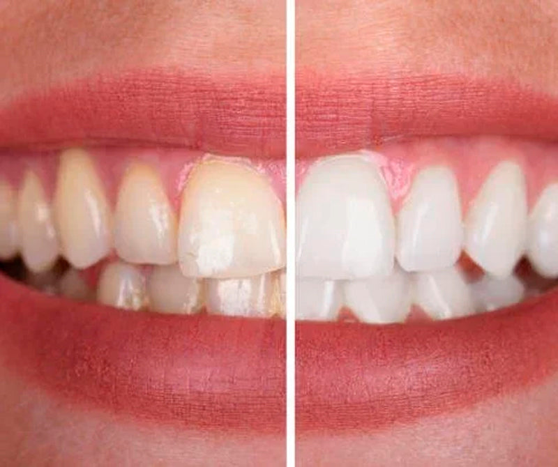 Teeth Color Correcting Serum