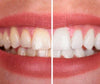 Teeth Color Correcting Serum