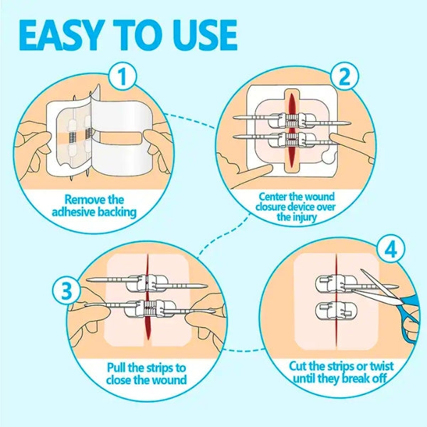 Senvok Emergency Wound Closure Device(PU 2 Straps)