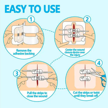 Senvok Emergency Wound Closure Device(PU 2 Straps)